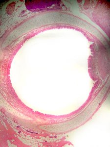 Tracheal wall histology