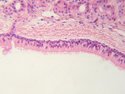 Ciliated pseudostratified epithelium