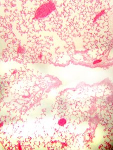 Alveolar sac and alveoli