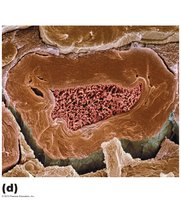 Electron micrograph of a myelinated axon.