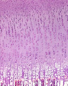 Histological section of epiphyseal plate showing zones of endochondral ossification