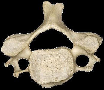 Typical cervical vertebra