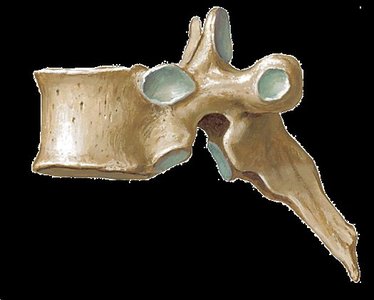 Lumbar vertebra