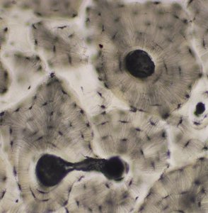 Microscopic view of compact bone showing osteons and canaliculi