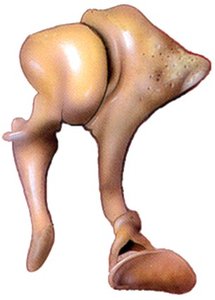 Auditory ossicles