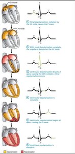 ECG waves and cardiac events