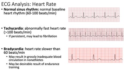 ECG analysis: heart rate