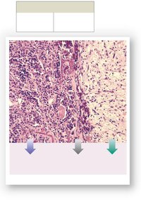 Histology of the pituitary gland showing anterior and posterior lobes