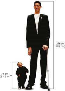 Disorders of pituitary growth hormone