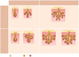 Types of multicellular exocrine glands