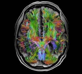 Brain structures involved in memory