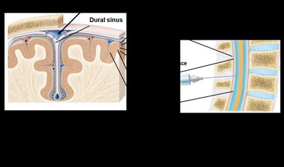 Dissection image showing the meninges on the brain