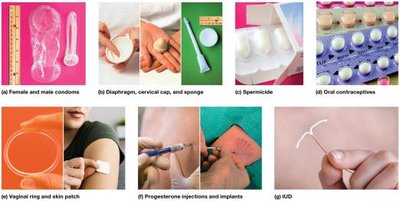 Temporary methods of birth control
