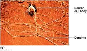 Neuron cell body and dendrite photomicrograph