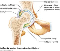 Frontal section through the right hip joint