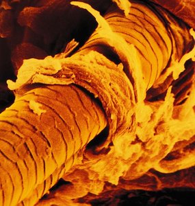 Scanning electron micrograph of a hair shaft
