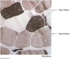Comparison of muscle fiber types