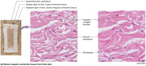 Dense irregular connective tissue from skin