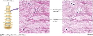 Fibrocartilage from intervertebral disc