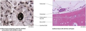 Bone tissue with ECM