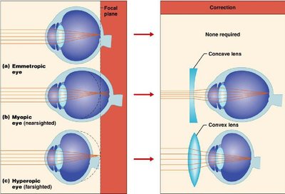 Refraction errors and lens correction