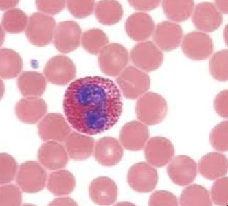 Eosinophil under microscope