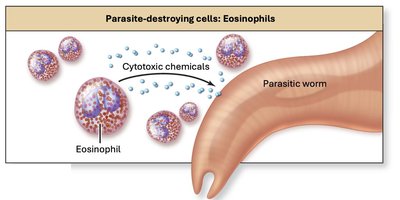 Eosinophil attacking parasite