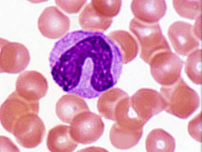 Monocyte under microscope