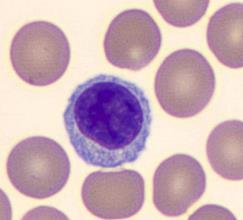 Lymphocyte under microscope