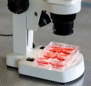 Leukocyte differential count