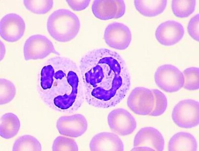 Neutrophils under microscope
