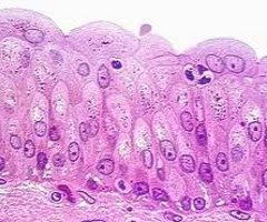 Dense irregular connective tissue
