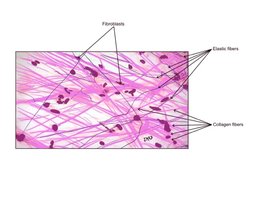 Dense elastic connective tissue from aorta