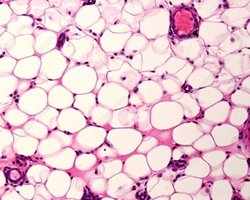 Hyaline cartilage histology