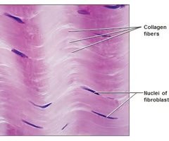 Fibrocartilage histology