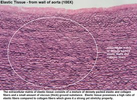Stratified squamous epithelium in skin