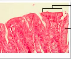 Adipose tissue