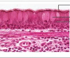 Dense regular connective tissue