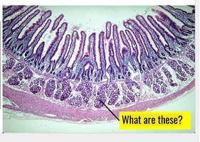 Histology of Brunner's glands in the duodenum