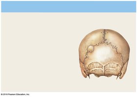 Posterior view of skull showing sutural bones