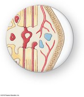 Spongy bone formation in fracture repair
