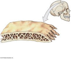 Structure of a flat bone (parietal bone)