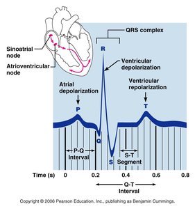 Normal sinus rhythm ECG trace