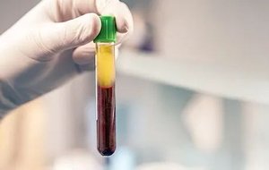 Centrifuged blood sample showing plasma and erythrocyte layers