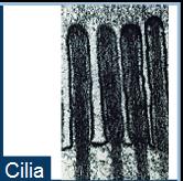 Electron micrograph of cilia