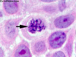 Photomicrograph of a cell in prophase