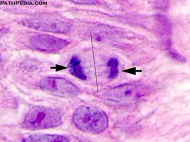 Photomicrograph of a cell in metaphase