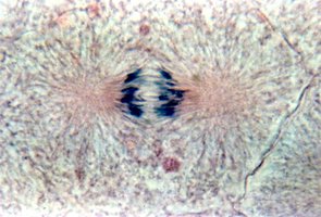 Photomicrograph of a cell in anaphase