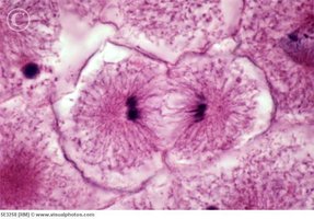 Photomicrograph of a cell in telophase/cytokinesis
