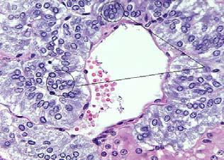 Histological section showing chromaffin cells